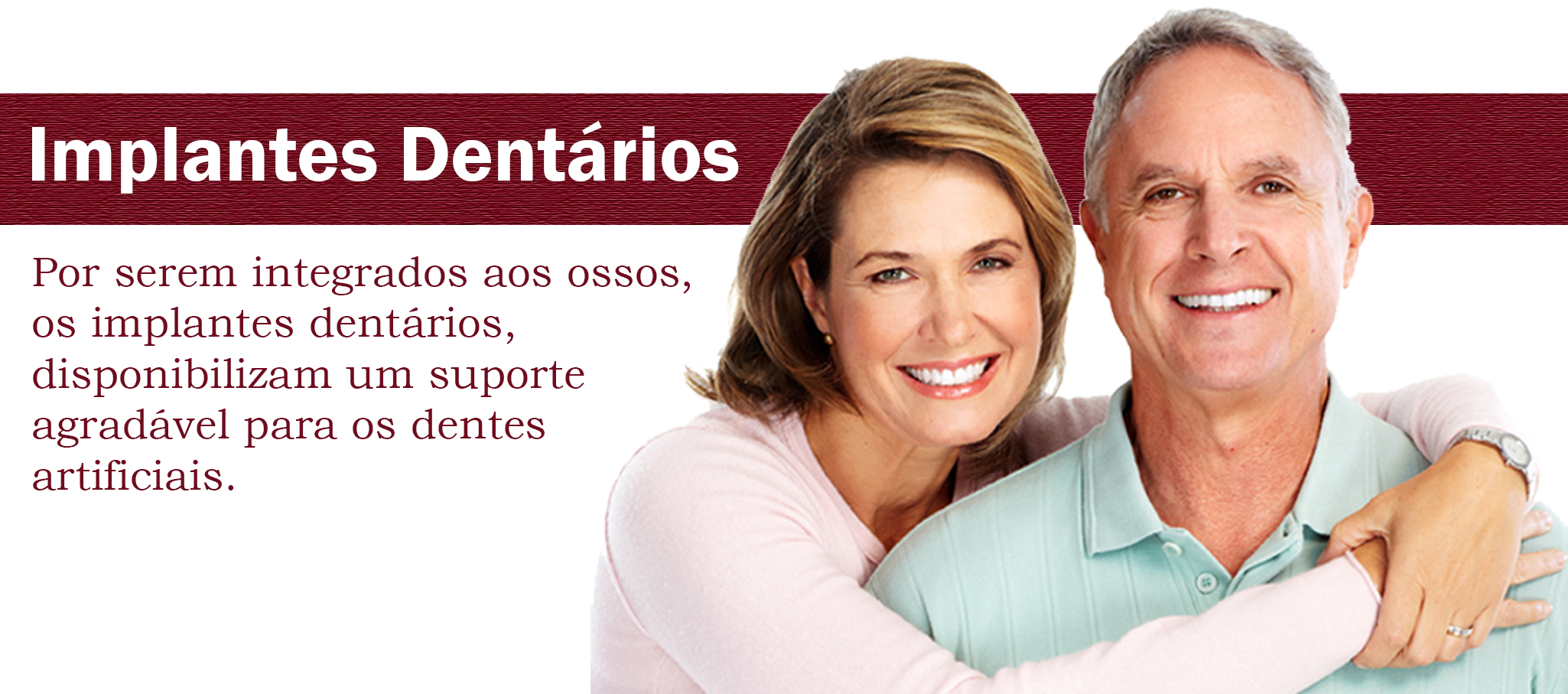 Implantes Dentários Implantes Dentários